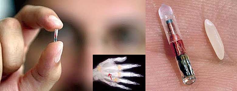 microchip