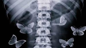 mariposas