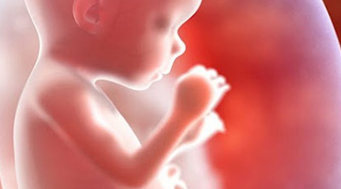 aborto