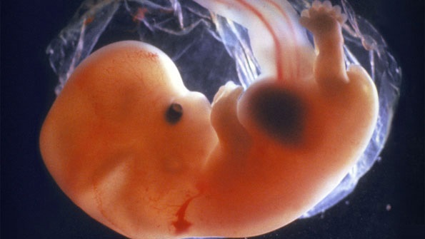 Aborto