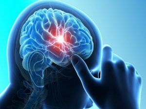 Cerebro