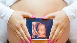 aborto